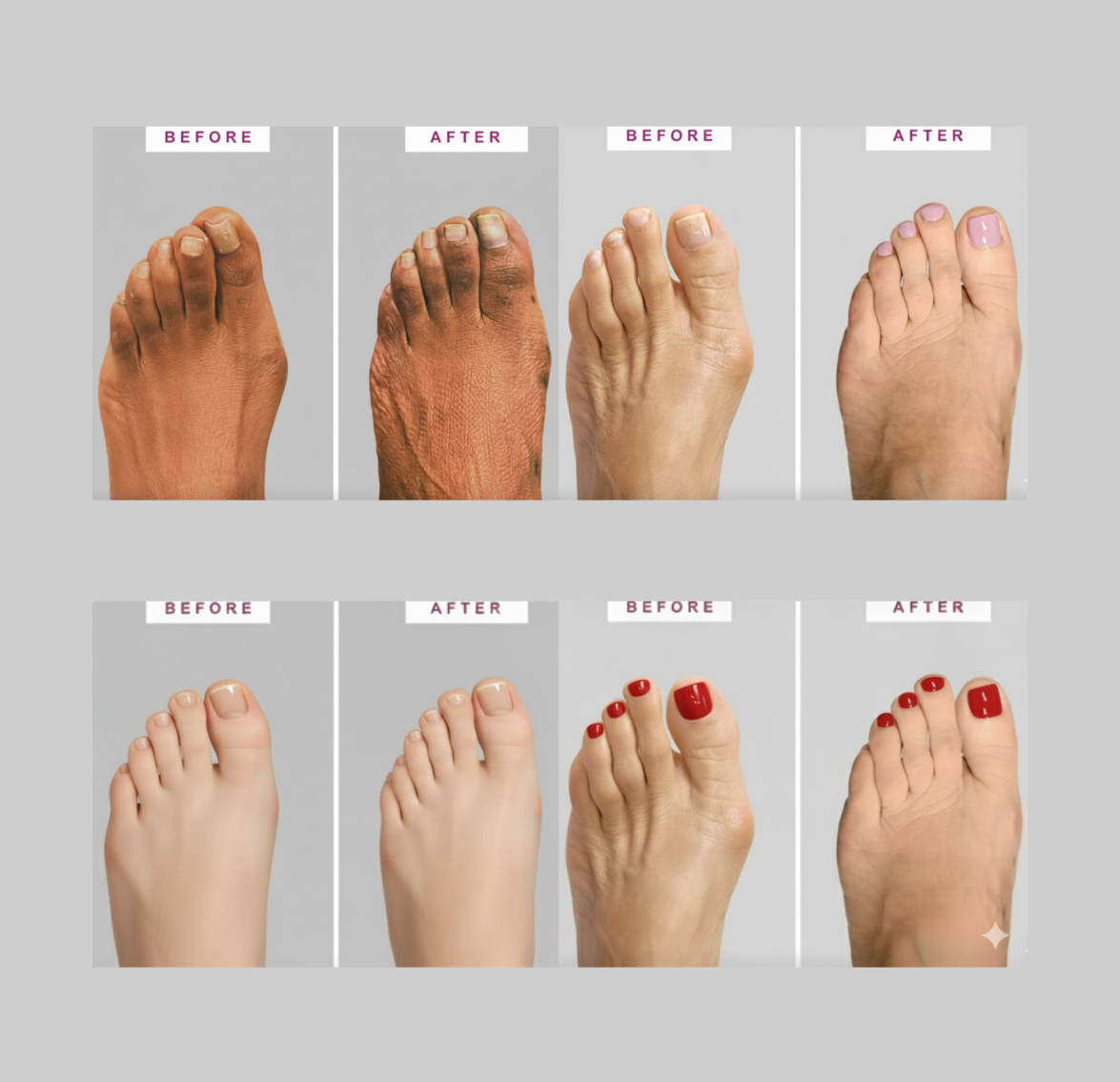Slim Fabric Toe Sleeve